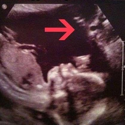 69164042_10157494895604299_6753828741450825728_n